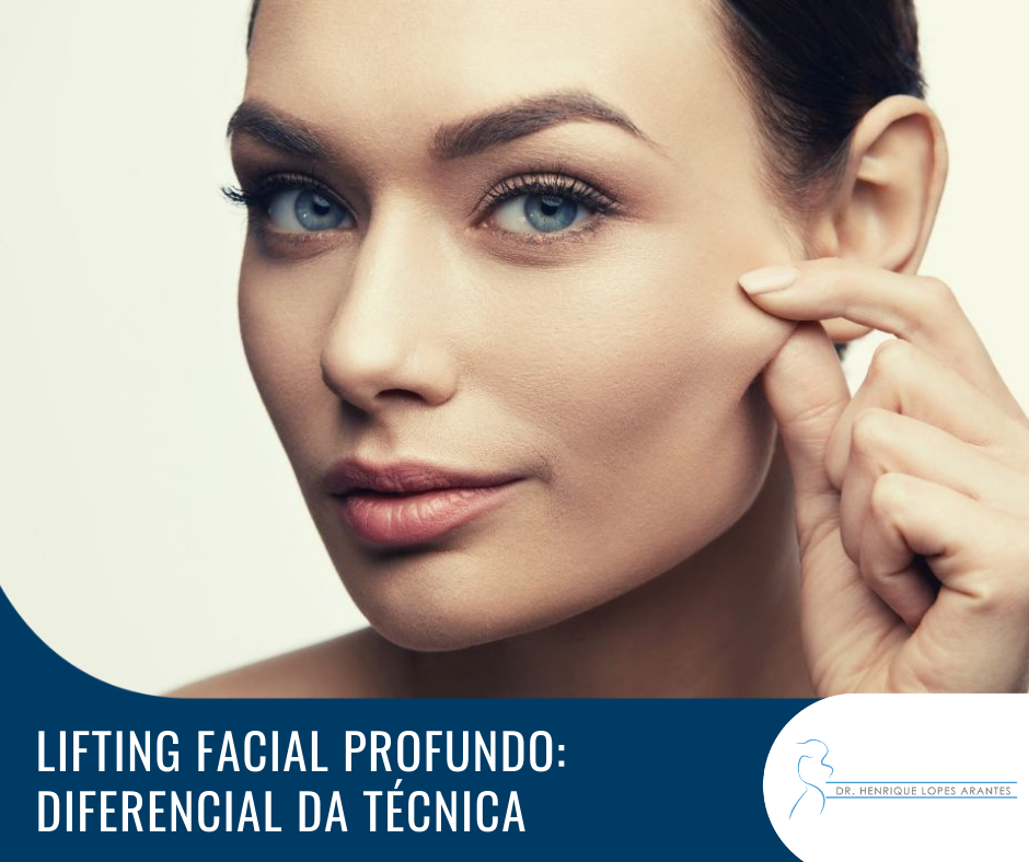 Imagem do artigo sobre lifting facial profundo